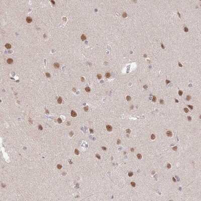 Immunohistochemistry-Paraffin: ZBTB7A/Pokemon Antibody [NBP2-38550]