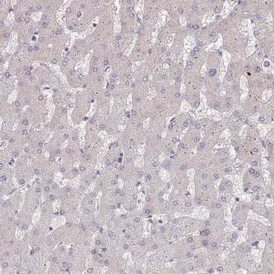 Immunohistochemistry-Paraffin: ZBTB7A/Pokemon Antibody [NBP2-38550]