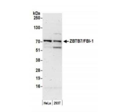 Western Blot: ZBTB7A/Pokemon Antibody [NB100-761]