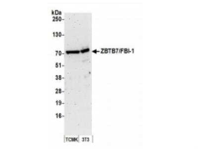 Western Blot: ZBTB7A/Pokemon Antibody [NB100-761]