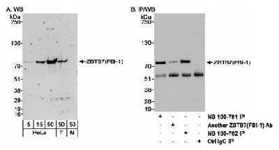 Western Blot: ZBTB7A/Pokemon Antibody [NB100-762]