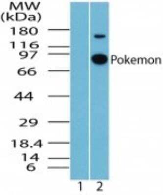 Western Blot: ZBTB7A/Pokemon Antibody [NBP2-23673]