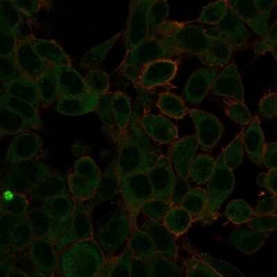 Immunocytochemistry/ Immunofluorescence: ZBTB7C Antibody (PCRP-ZBTB7C-4E12) - Azide and BSA Free [NBP3-08894]