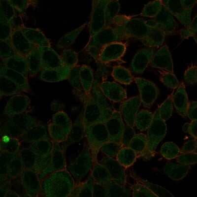 Immunocytochemistry/ Immunofluorescence: ZBTB7C Antibody (PCRP-ZBTB7C-4E12) [NBP3-07152]