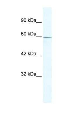 Western Blot: ZBTB7C Antibody [NBP1-91522]