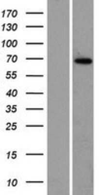 Western Blot: ZBTB7C Overexpression Lysate [NBP2-08570]