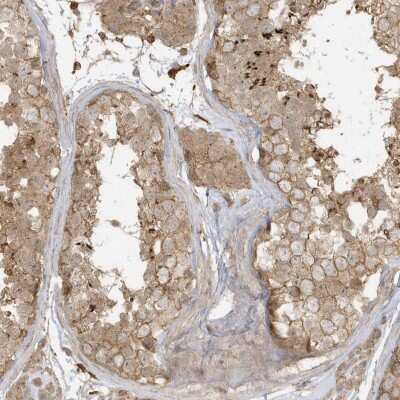 Immunohistochemistry-Paraffin: ZBTB8A Antibody [NBP2-48618]