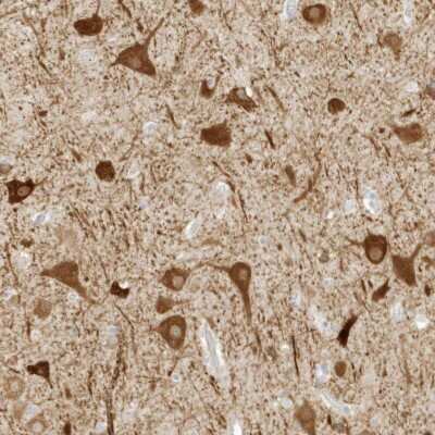 Immunohistochemistry-Paraffin: ZBTB8A Antibody [NBP2-48619]