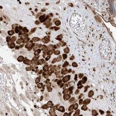 Immunohistochemistry-Paraffin: ZBTB8A Antibody [NBP1-88375]