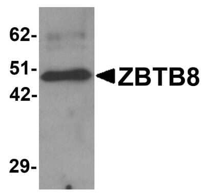 Western Blot: ZBTB8A AntibodyBSA Free [NBP1-76521]