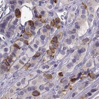 Immunohistochemistry-Paraffin: ZBTB8B Antibody [NBP2-46826]