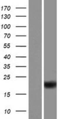 Western Blot: ZBTB8OS Overexpression Lysate [NBP2-04962]