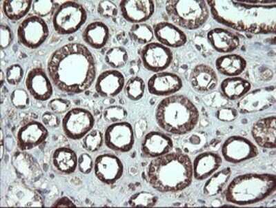 Immunohistochemistry: CGI 62 Antibody (OTI4C1) [NBP2-45700]