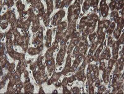 Immunohistochemistry: CGI 62 Antibody (OTI4C1) [NBP2-45700]