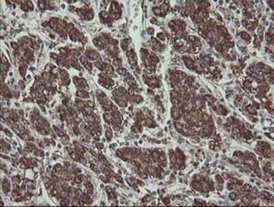 Immunohistochemistry: CGI 62 Antibody (OTI4C1) [NBP2-45700]