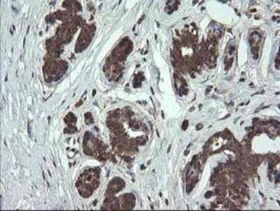 Immunohistochemistry: CGI 62 Antibody (OTI4C1) [NBP2-45700]