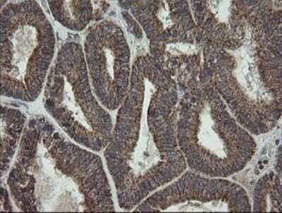 Immunohistochemistry: CGI 62 Antibody (OTI4C1) [NBP2-45700]