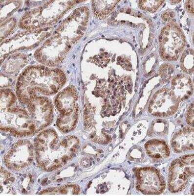 Immunohistochemistry-Paraffin: ZC3H10 Antibody [NBP1-82233]