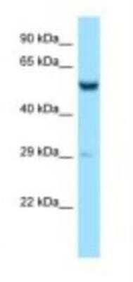 Western Blot: ZC3H10 Antibody [NBP1-98380]