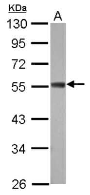 Western Blot: ZC3H10 Antibody [NBP2-20938]