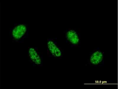Immunocytochemistry/ Immunofluorescence: ZC3H11A Antibody [H00009877-B01P]