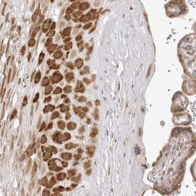 Immunohistochemistry-Paraffin: ZC3H11A Antibody [NBP1-82973]