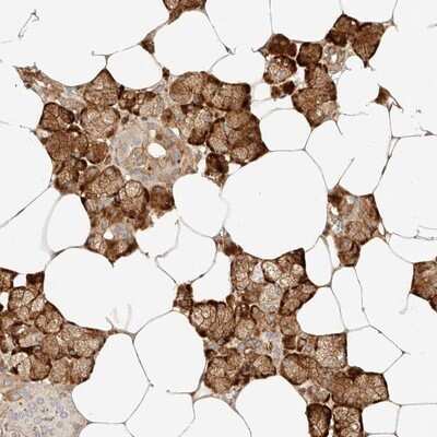 Immunohistochemistry-Paraffin: ZC3H11A Antibody [NBP1-82974]