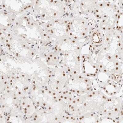 Immunohistochemistry-Paraffin: ZC3H11A Antibody [NBP1-82975]