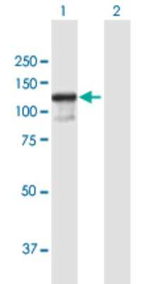 Western Blot: ZC3H11A Antibody [H00009877-B01P]