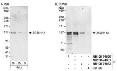 Western Blot: ZC3H11A Antibody [NB100-74650]