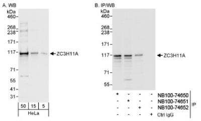 Western Blot: ZC3H11A Antibody [NB100-74651]