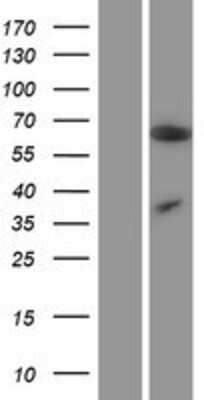 Western Blot: MCPIP1/ZC3H12A Overexpression Lysate [NBP2-06242]