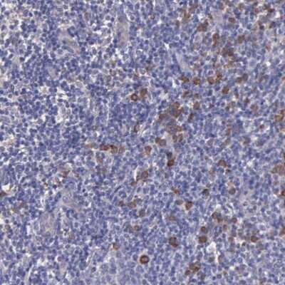 Immunohistochemistry-Paraffin: ZC3H12B Antibody [NBP1-84332]