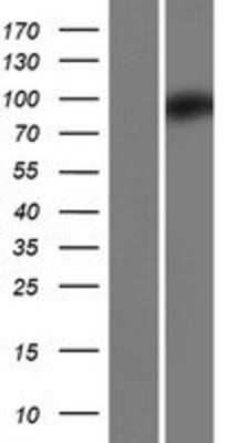 Western Blot: ZC3H12B Overexpression Lysate [NBP2-08768]