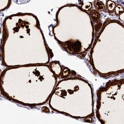 Immunohistochemistry: ZC3H12C Antibody [NBP2-48695]