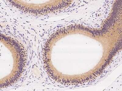 Immunohistochemistry-Paraffin: ZC3H12C Antibody [NBP2-97880]