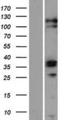 Western Blot: ZC3H12C Overexpression Lysate [NBP2-05883]