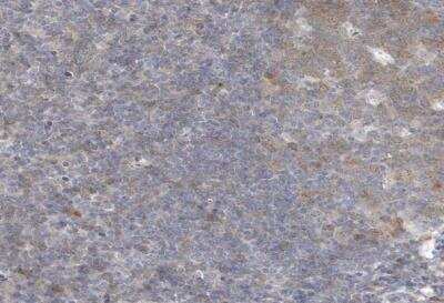 Immunohistochemistry-Paraffin: ZC3H12D Antibody [NBP1-91249]