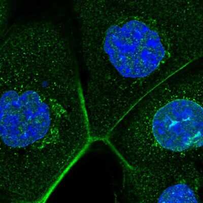 Immunocytochemistry/ Immunofluorescence: ZC3H13 Antibody [NBP2-48722]