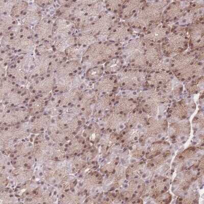 Immunohistochemistry: ZC3H13 Antibody [NBP2-47575]