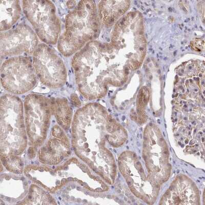 Immunohistochemistry: ZC3H13 Antibody [NBP2-48705]