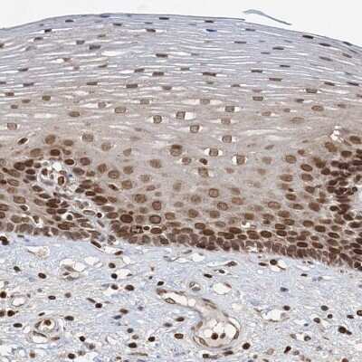 Immunohistochemistry-Paraffin: ZC3H13 Antibody [NBP2-48722]