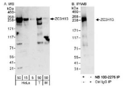 Western Blot: ZC3H13 Antibody [NB100-2276]