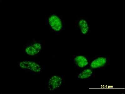Immunocytochemistry/ Immunofluorescence: ZC3H14 Antibody [H00079882-B01P]