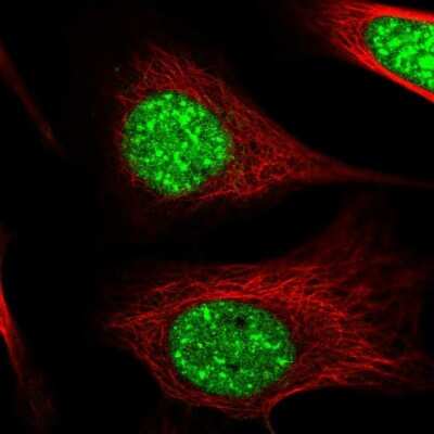 Immunocytochemistry/ Immunofluorescence: ZC3H14 Antibody [NBP2-49087]