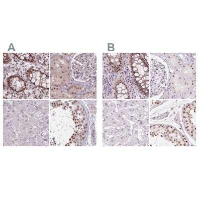 Immunohistochemistry-Paraffin: ZC3H14 Antibody [NBP2-13537]