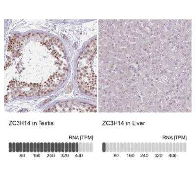 Immunohistochemistry-Paraffin: ZC3H14 Antibody [NBP2-13537]