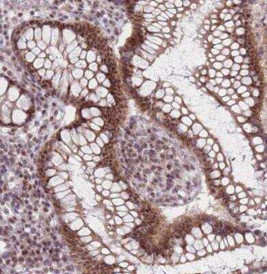 Immunohistochemistry-Paraffin: ZC3H14 Antibody [NBP2-13537]