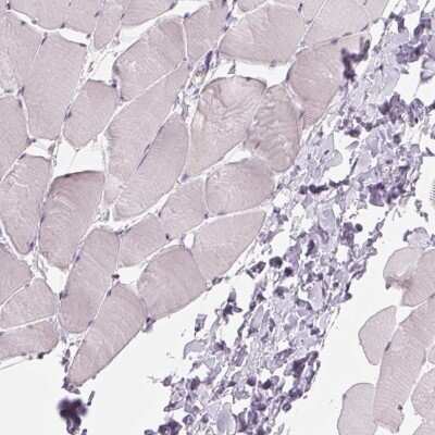Immunohistochemistry-Paraffin: ZC3H14 Antibody [NBP2-49087]