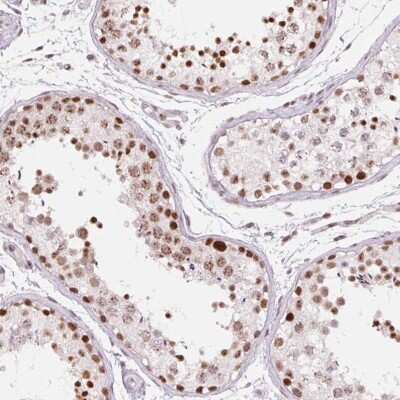 Immunohistochemistry-Paraffin: ZC3H14 Antibody [NBP2-49087]